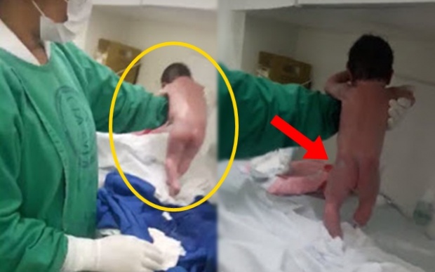 งงเป็นไก่ตาแตก!! “ทารกแรกคลอด” สามารถเดินได้!! พางงทั้งโรงพยาบาล (คลิป)
