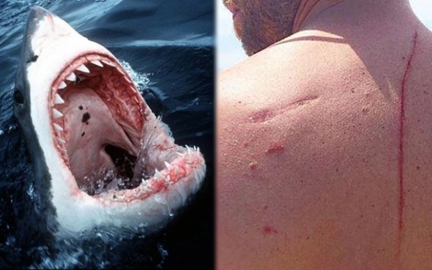หนุ่มพาลูกลงเล่นน้ำทะเล ถูกฉลามกัดบาดเจ็บสาหัส แต่กลับต้องขอบคุณฉลามร้ายตัวนั้น? (คลิป)