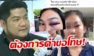 “เบน ชลาทิศ” ต่อยหญิง! สาวตาเขียวเปิดใจ หวังได้คำขอโทษ เสียดายอุตส่าห์ปลื้ม (คลิป)