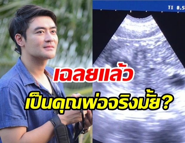 หยุดเดา..“เติ้ล ธนพล” เฉลยแล้ว คลิปอัลตราซาวด์ สรุปแล้วลูกใคร!?