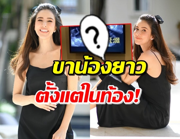 ศรีริต้า เผยคลิปอัลตร้าซาวด์ลูกครั้งแรก ส่องเลยขาเหมือนใคร!? (คลิป)