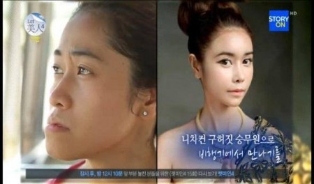 เจาะลึก! 2 สาวไทยที่โชคดีได้ทำศัลยกรรมฟรีที่เกาหลี