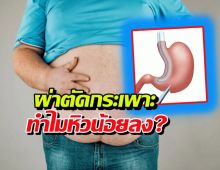 ทำไมผ่าตัดกระเพาะ กินน้อย แต่ไม่เกิดโยโย่