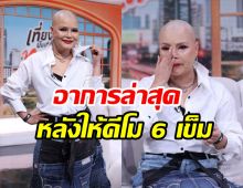 ไก่ จันทน์จวง เปิดใจสู้มะเร็งร้าย พร้อมโมเมนต์ที่กลั้นน้ำตาไว้ไม่อยู่