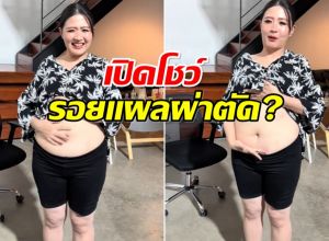 โฟกัส จีระกุล เฉลย ที่ผอมลงเร็วเพราะผ่าตัดกระเพาะ?