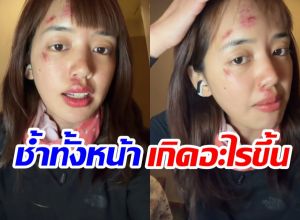 เเฟนๆห่วง พลอยไพลิน หน้าช้ำหลังกลับจากทริปแอนตาร์กติกา