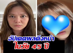 เปิดภาพ Before & After! พิมพ์ พิมพ์มาดา วัย 45 สวยสับหน้าเด็กกระชากวัย