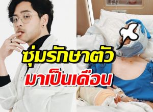 ทอม อิศรา ประสบอุบัติเหตุรุนแรง เผยอาการเป็นหนักกว่าที่คิด