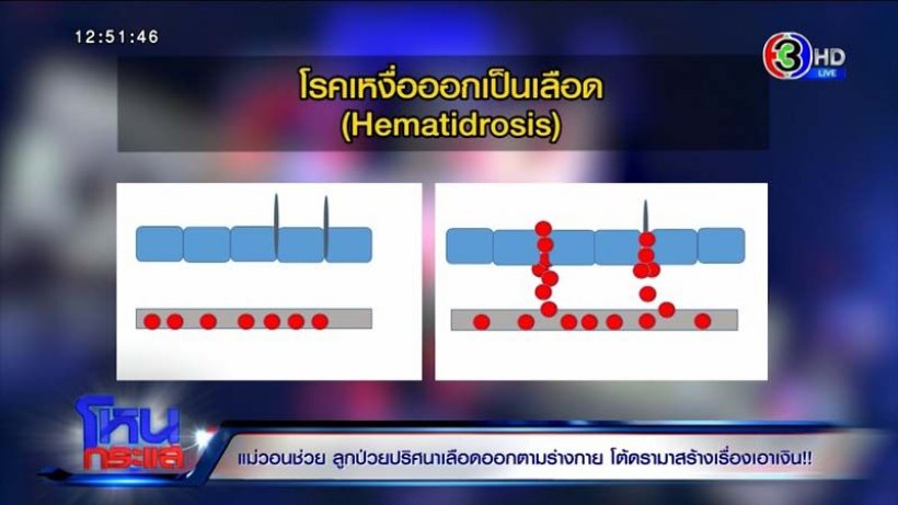 แม่โต้ดราม่าสร้างเรื่องลูกเลือดออกตามตัวเอาเงิน-หมอยันพบได้1ใน2ล้านคน