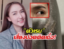 สาวซื้อเตียงใหม่ เจอแมงนับล้าน ทำผื่นขึ้นเต็มตัว อึ้งที่แท้ “ตัวเรน” – หมอชี้เสี่ยงปอดติดเชื้อ (คลิป)